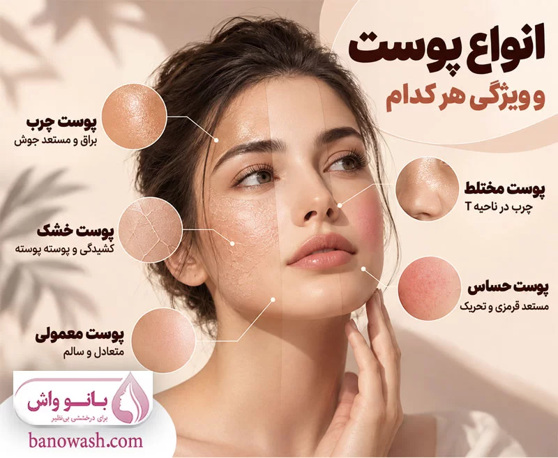 انواع پوست و ویژگی هر کدام